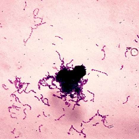 Macromodelo dental y cepillo de dientes